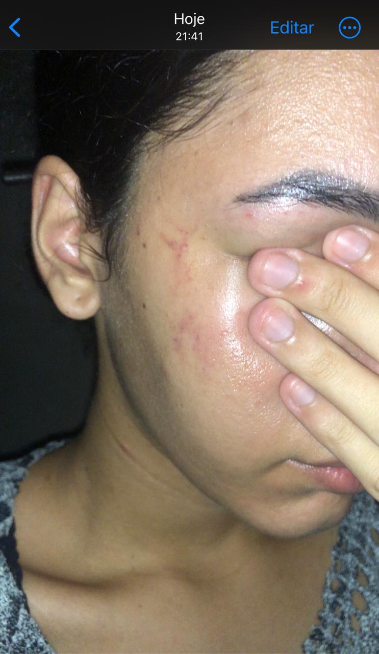 Estagiária da Facape denuncia agressão durante atendimento; faculdade garante que vai dar suporte e ampliar segurança